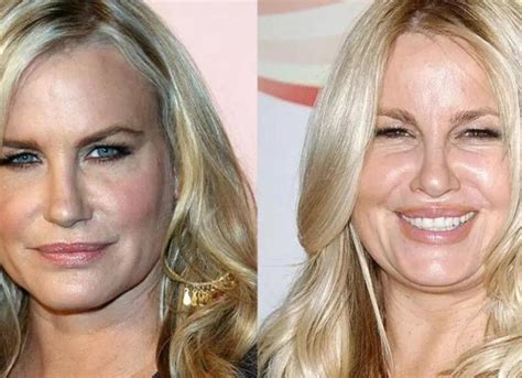 jennifer coolidge before plastic surgery|Jennifer Coolidge Plastic Surgery Before And After